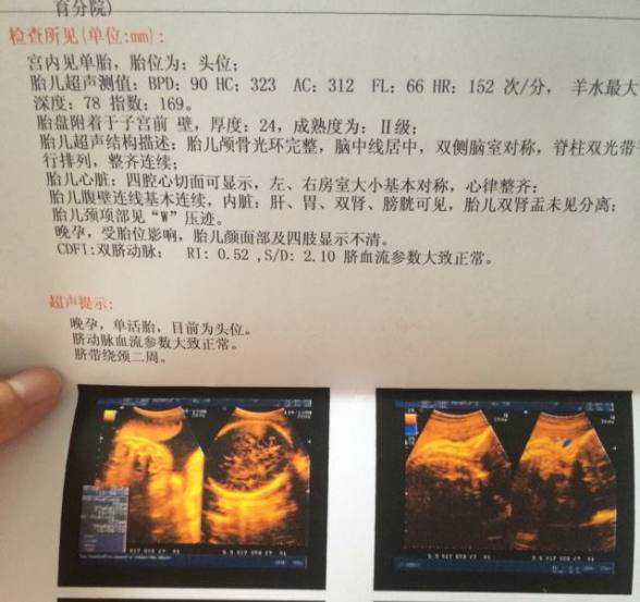 北京私人代孕价格表，北京的甲亢价格